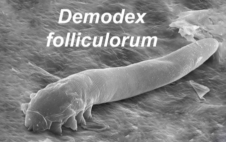 Demodex_folliculorum_SEM_crop